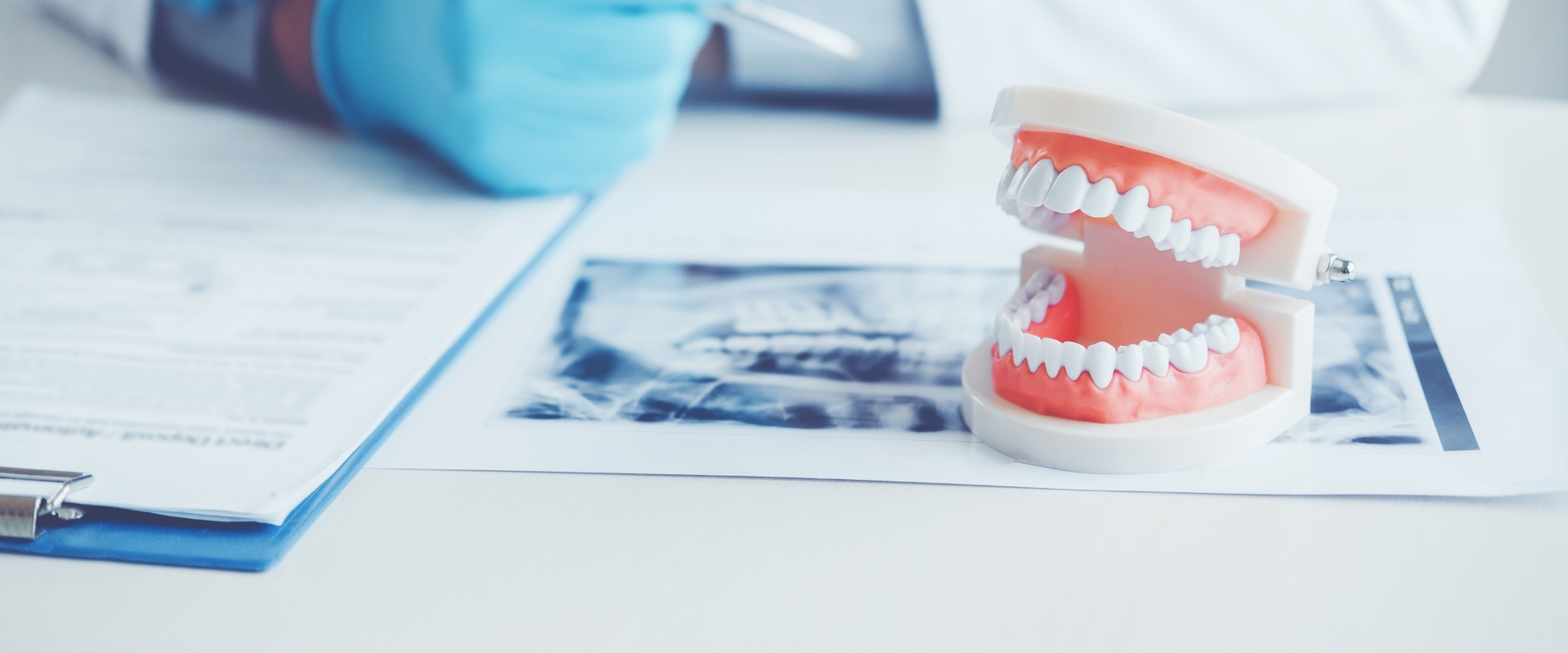 Fisa medicala dentara si importanta ei | Life Dental Spa