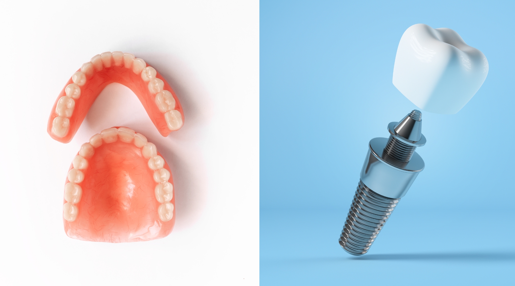 proteza dentara versus implant dentar