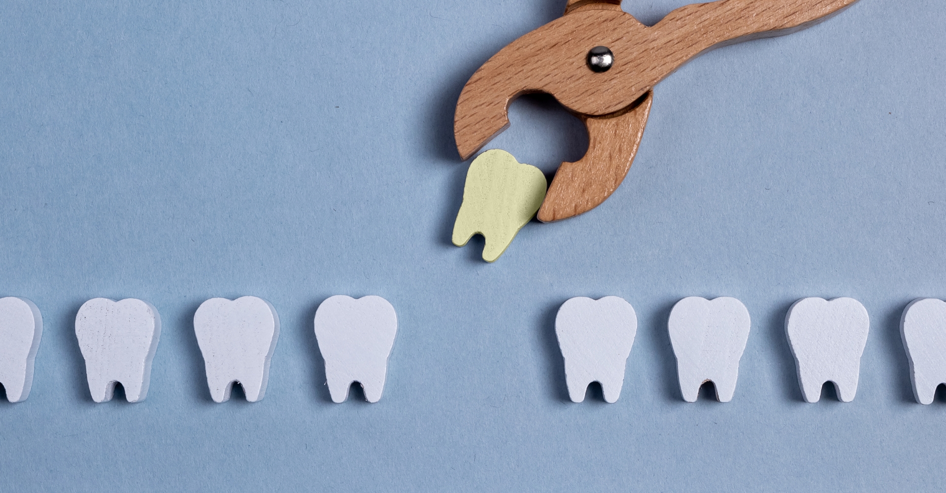 cand este necesara extractia dentara