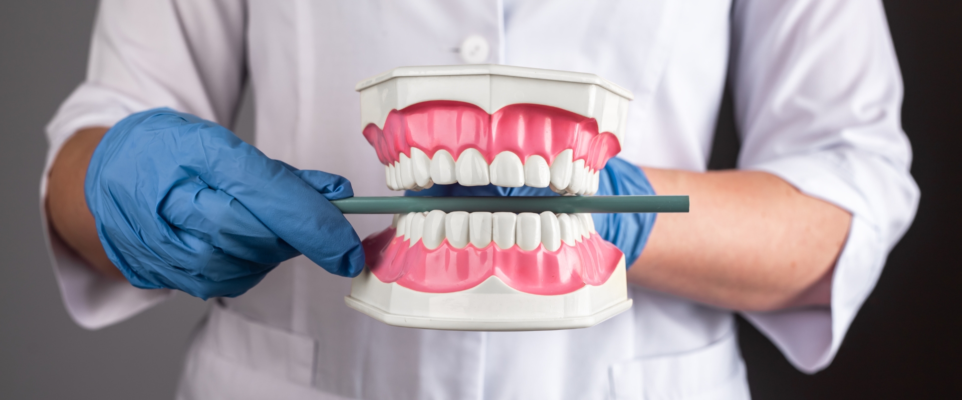 ocluzie dentara ce inseamna si tipuri