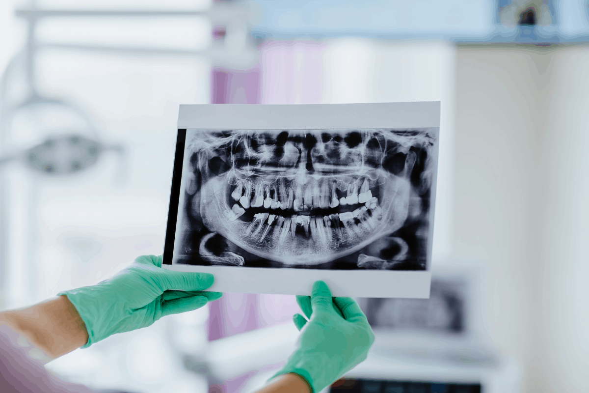 Radiografie Dentara