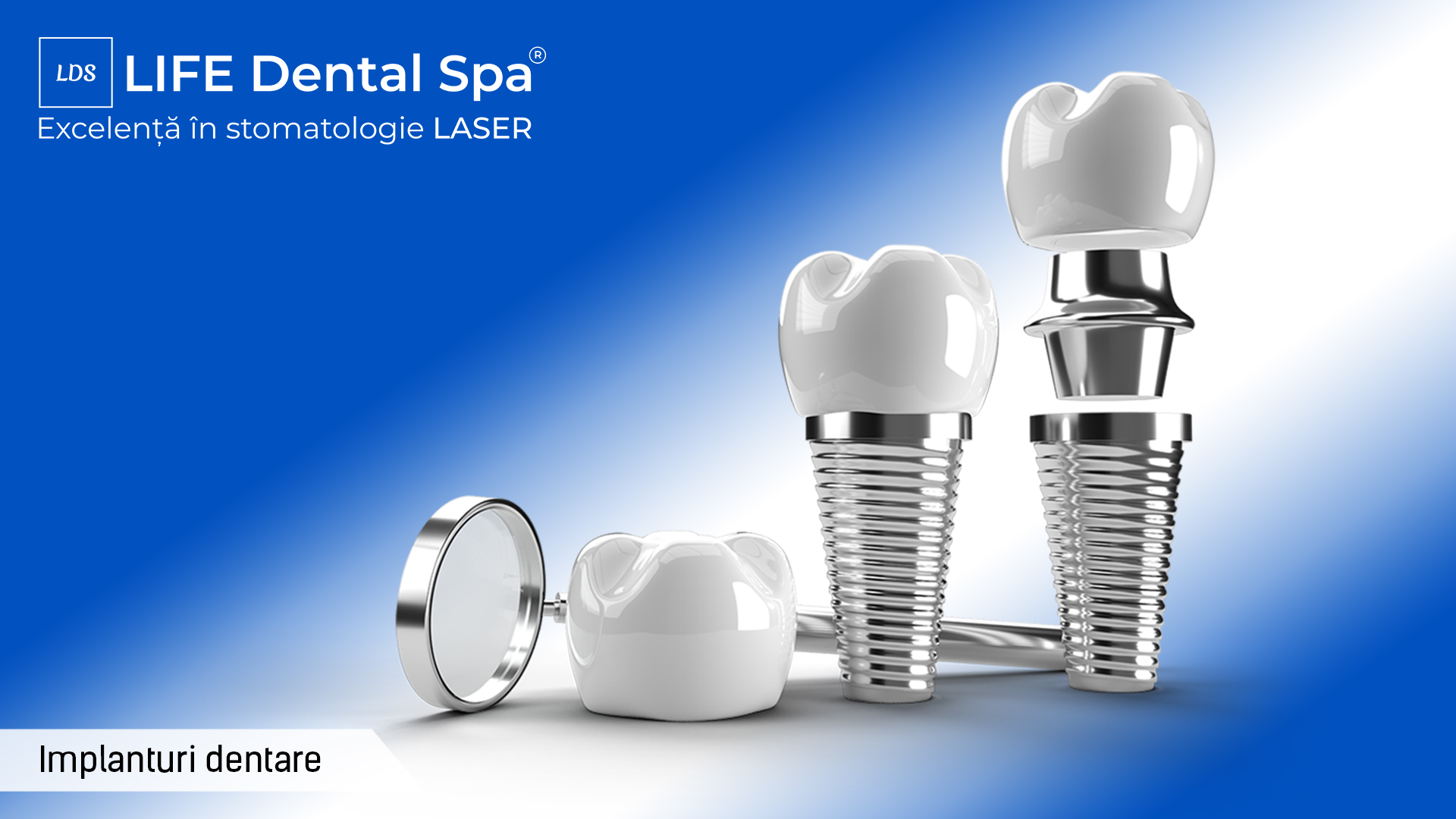 Implanturi dentare: mituri