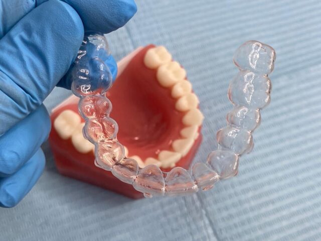 aparat dentar spark pentru o igiena orala perfecta
