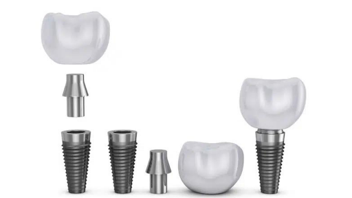 componentele implantului dentar
