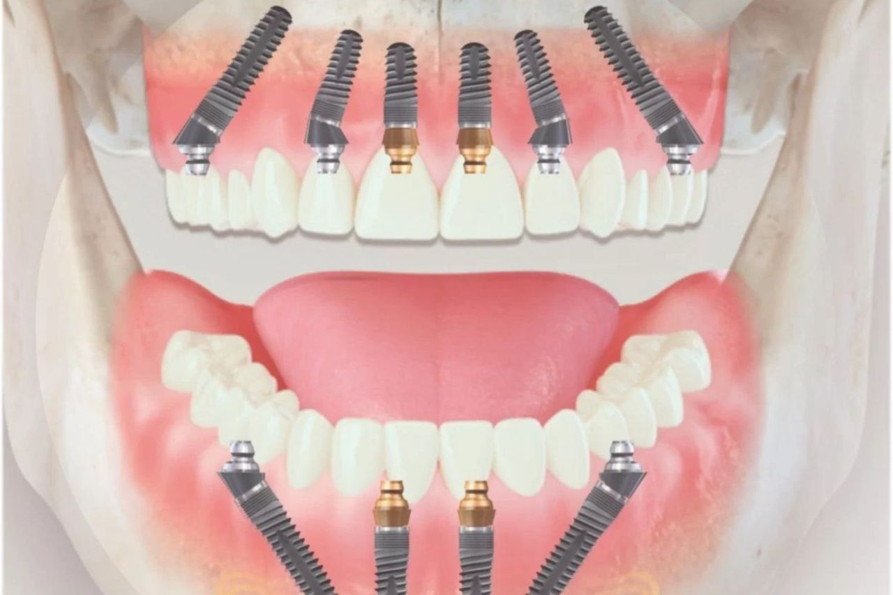 false teeth